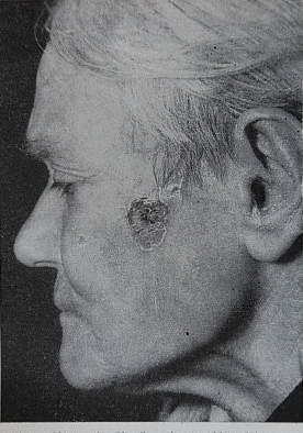 Georges Lakhovsky MWO